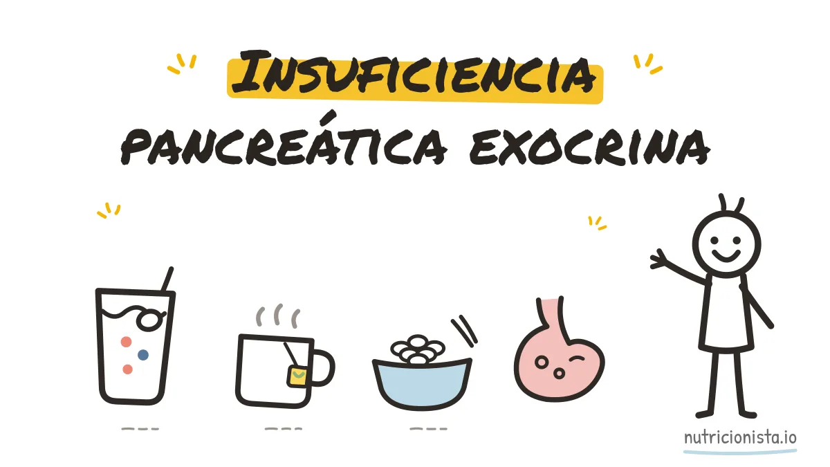 Insuficiencia pancreática exocrina